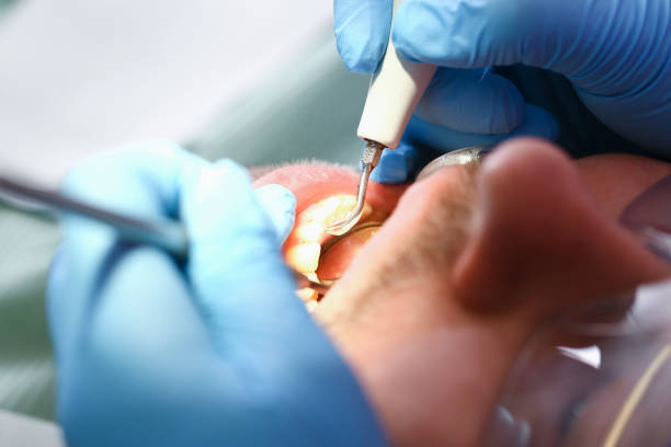 Best Emergency Dental Care for Trauma or Injury in Crystal City, TX