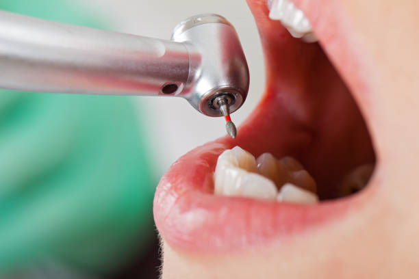 Best After-Hours Emergency Dentist in Crystal City, TX